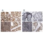 TPR Antibody in Immunohistochemistry (IHC)