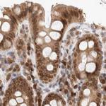 TPR Antibody in Immunohistochemistry (IHC)