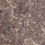 TPR Antibody in Immunohistochemistry (IHC)