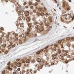 TPR Antibody in Immunohistochemistry (IHC)