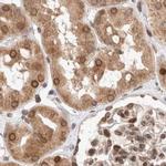 TPR Antibody in Immunohistochemistry (IHC)