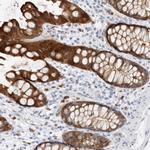 NAPE PLD Antibody in Immunohistochemistry (Paraffin) (IHC (P))