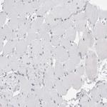 SMARCC1 Antibody in Immunohistochemistry (Paraffin) (IHC (P))