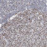 SMARCC1 Antibody in Immunohistochemistry (Paraffin) (IHC (P))