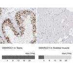 SMARCC1 Antibody in Immunohistochemistry (IHC)