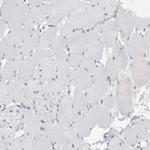 SMARCC1 Antibody in Immunohistochemistry (IHC)