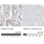 SMARCC1 Antibody