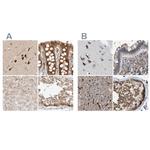 GCN1L1 Antibody in Immunohistochemistry (IHC)