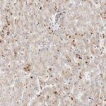 GCN1L1 Antibody in Immunohistochemistry (IHC)