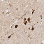 GCN1L1 Antibody in Immunohistochemistry (IHC)