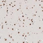 ZNF282 Antibody in Immunohistochemistry (Paraffin) (IHC (P))