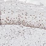 ZNF282 Antibody in Immunohistochemistry (Paraffin) (IHC (P))