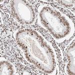 ZNF282 Antibody in Immunohistochemistry (Paraffin) (IHC (P))