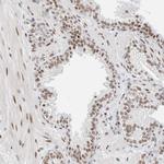 ZNF282 Antibody in Immunohistochemistry (Paraffin) (IHC (P))