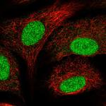 SNAPC5 Antibody in Immunocytochemistry (ICC/IF)