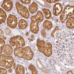 SNAPC5 Antibody in Immunohistochemistry (Paraffin) (IHC (P))