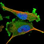 ADSS Antibody in Immunocytochemistry (ICC/IF)