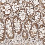 ADSS Antibody in Immunohistochemistry (IHC)