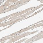 ADSS Antibody in Immunohistochemistry (IHC)