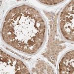 ADSS Antibody in Immunohistochemistry (IHC)