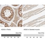 ADSS Antibody