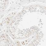 TSR1 Antibody in Immunohistochemistry (IHC)