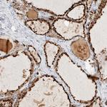 PGCP Antibody in Immunohistochemistry (IHC)