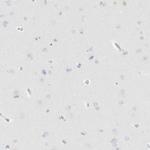 PGCP Antibody in Immunohistochemistry (IHC)