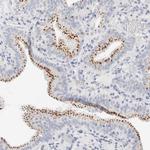 PGCP Antibody in Immunohistochemistry (IHC)