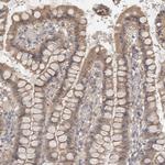 NR1 Antibody in Immunohistochemistry (Paraffin) (IHC (P))