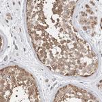 NR1 Antibody in Immunohistochemistry (Paraffin) (IHC (P))