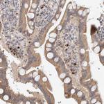 B3GNTL1 Antibody in Immunohistochemistry (Paraffin) (IHC (P))