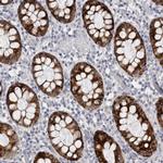 PWP2 Antibody in Immunohistochemistry (Paraffin) (IHC (P))