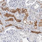 SLC22A12 Antibody in Immunohistochemistry (Paraffin) (IHC (P))