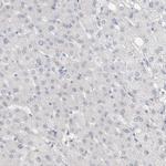 SLC22A12 Antibody in Immunohistochemistry (Paraffin) (IHC (P))