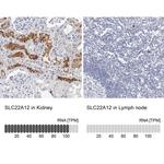 SLC22A12 Antibody in Immunohistochemistry (IHC)