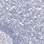 SLC22A12 Antibody in Immunohistochemistry (IHC)