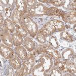 NEDD4L Antibody in Immunohistochemistry (Paraffin) (IHC (P))