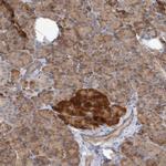 NEDD4L Antibody in Immunohistochemistry (Paraffin) (IHC (P))