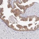 NEDD4L Antibody in Immunohistochemistry (Paraffin) (IHC (P))