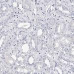 ADAM2 Antibody in Immunohistochemistry (Paraffin) (IHC (P))