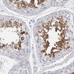 ADAM2 Antibody in Immunohistochemistry (Paraffin) (IHC (P))