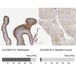 SLC38A10 Antibody in Immunohistochemistry (IHC)