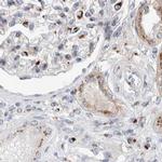 SLC38A10 Antibody in Immunohistochemistry (IHC)