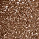 PGM1 Antibody in Immunohistochemistry (Paraffin) (IHC (P))