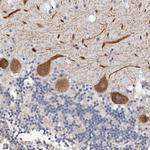 ARHGEF10 Antibody in Immunohistochemistry (Paraffin) (IHC (P))