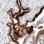 KIAA1456 Antibody in Immunohistochemistry (IHC)