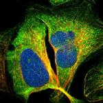 ACSF2 Antibody in Immunocytochemistry (ICC/IF)