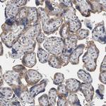 ACSF2 Antibody in Immunohistochemistry (Paraffin) (IHC (P))