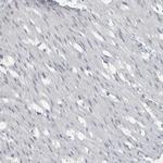 ACSF2 Antibody in Immunohistochemistry (IHC)